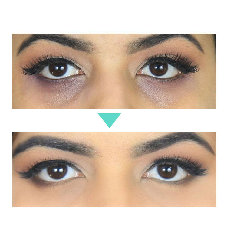 Eye Cream — 30ml