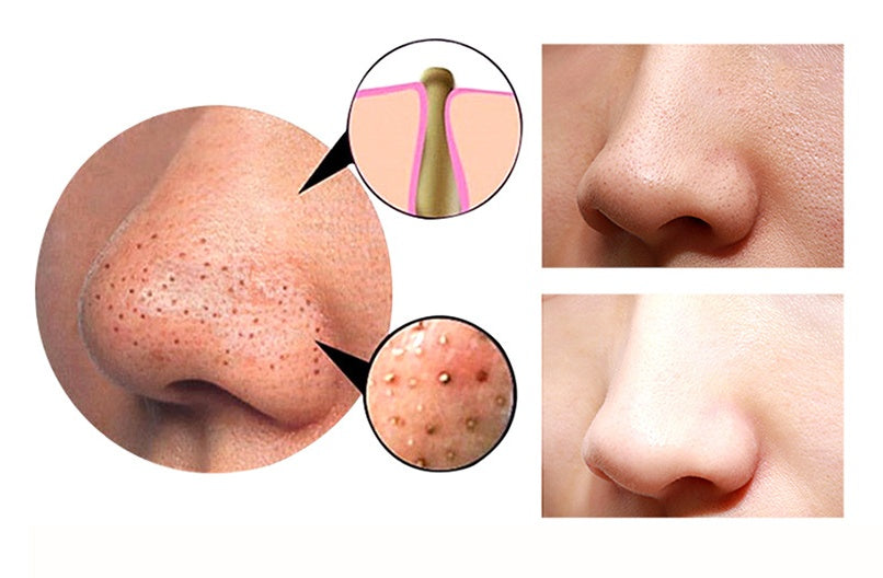 4-in-1 Body Gua Sha Cupping & Pore Cleanser