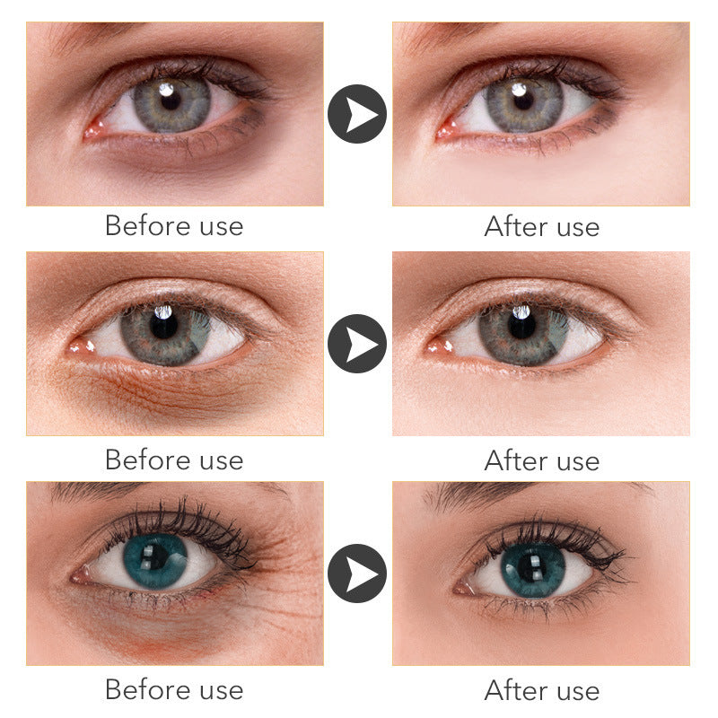 Eye Cream — 30ml