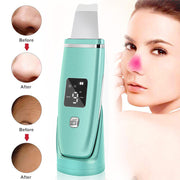 Ultrasonic Pore Cleanser — Blackhead Remover