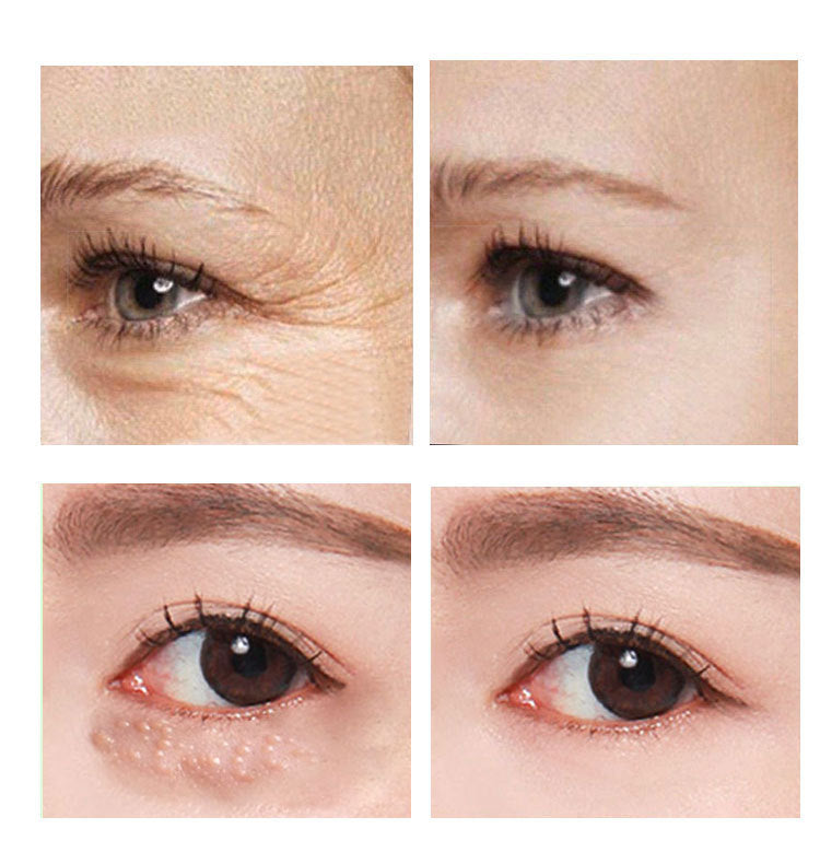 Eye Cream — 30ml